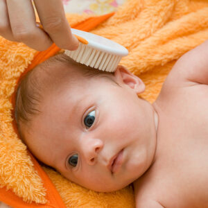 ریزش موی نوزادان