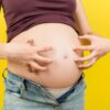 تغییرات پوست در بارداری شاخص