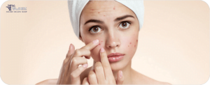 کرم ضد جوش رنگی درمومدیک بژ طبیعی