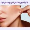 آیا اپیلاسیون پوست رو شل میکنه