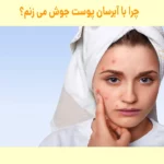 چرا با آبرسان پوست جوش می زنم؟