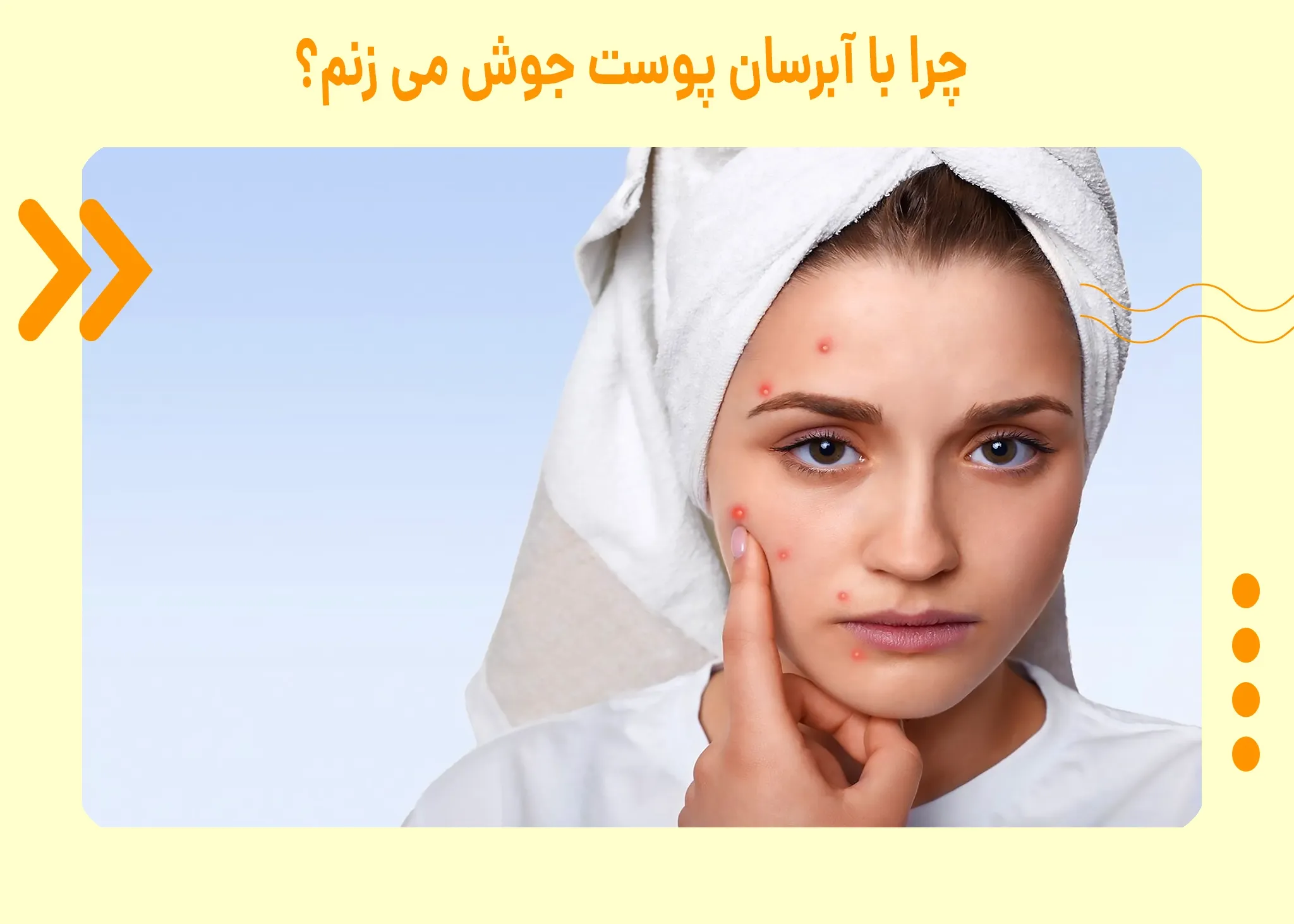 چرا با آبرسان پوست جوش می زنم؟