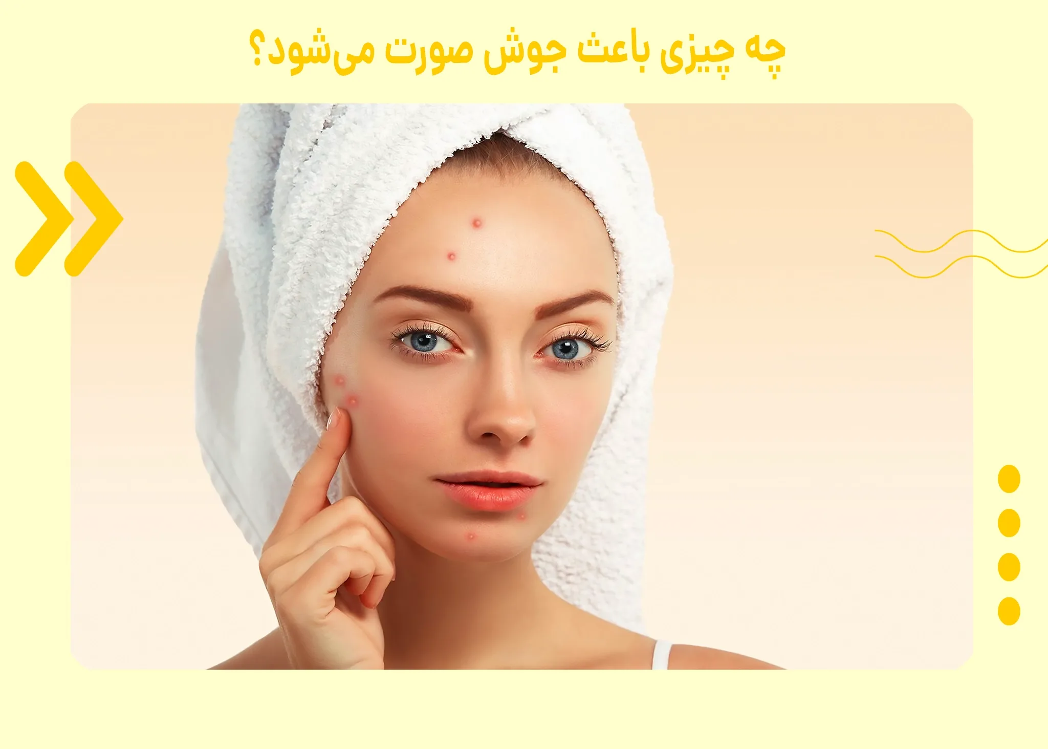 چه چیزی باعث جوش صورت میشود