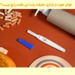 آیا جوش صورت از علائم بارداری است