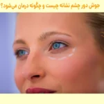 جوش دور چشم نشانه چیست