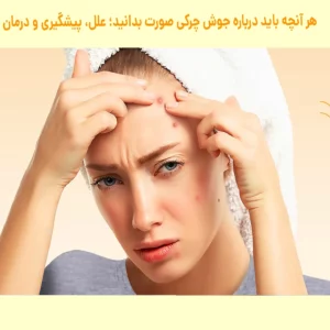 جوش چرکی صورت نشانه چیست