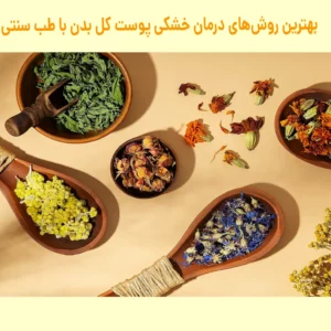 درمان خشکی پوست کل بدن در طب سنتی