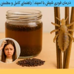 درمان فوری شپش با اسپند