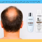 بهترین شامپو برای جلوگیری از ریزش مو و رشد مجدد مو