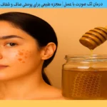 درمان لک صورت با عسل