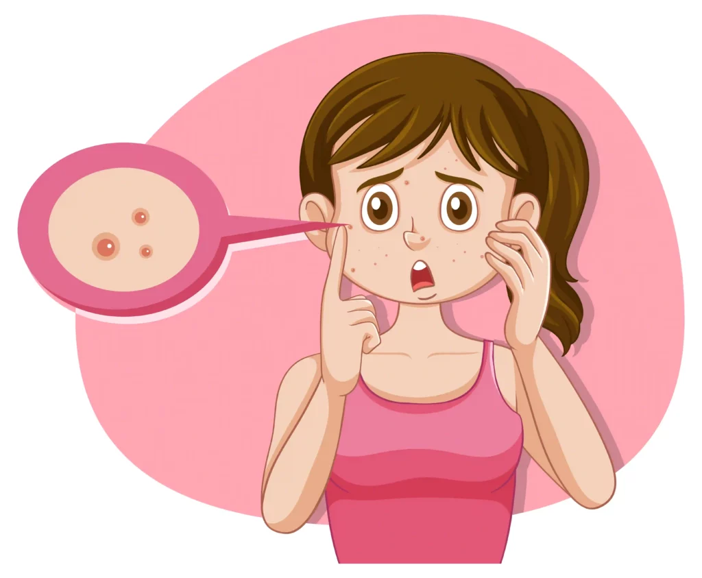 نحوه مصرف کلیندامایسین برای جوش
