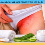 علت و درمان عرق سوز شدن لای پا و کشاله ران