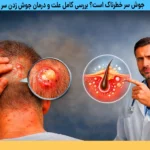 علت و درمان جوش زدن سر