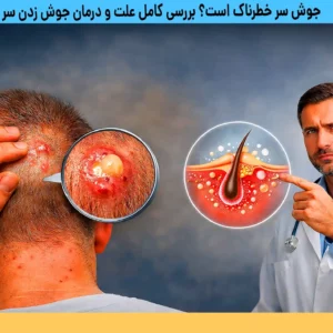 علت و درمان جوش زدن سر
