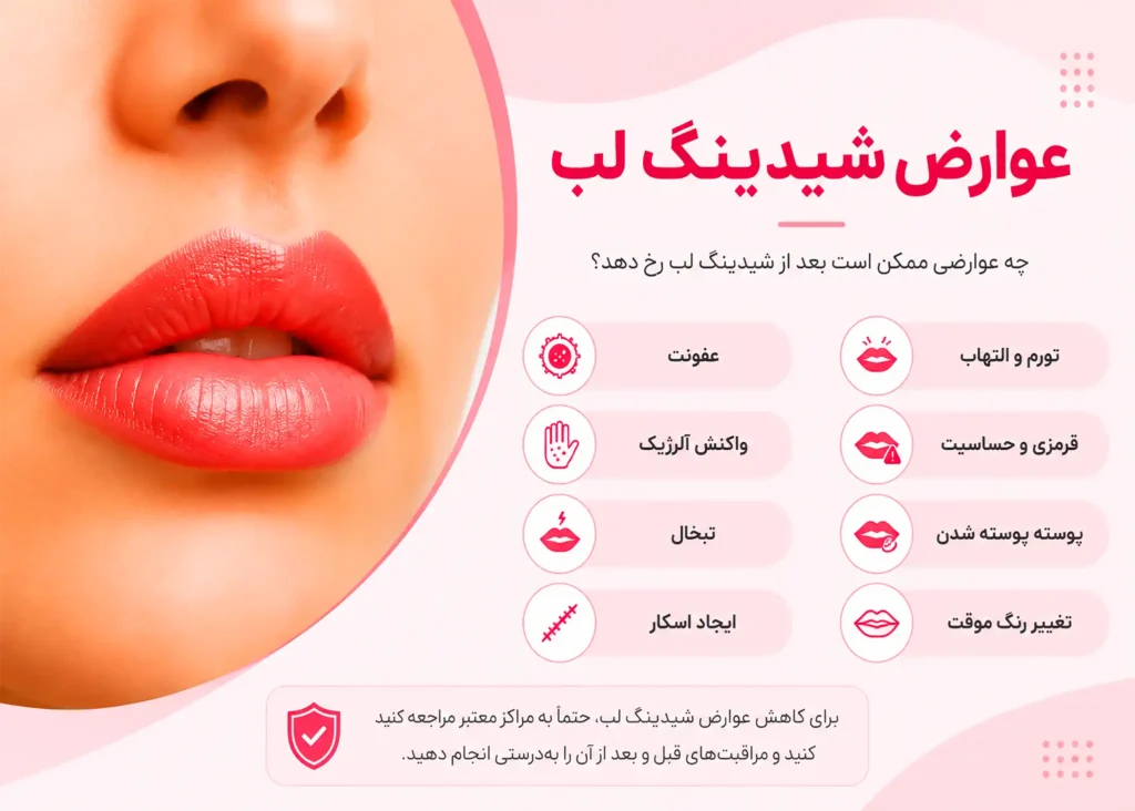 پشیمانی شیدینگ لب